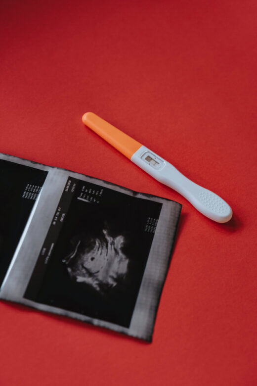 Symbolbild: Schwangerschaftstest und Ultraschallbild auf einem Tisch