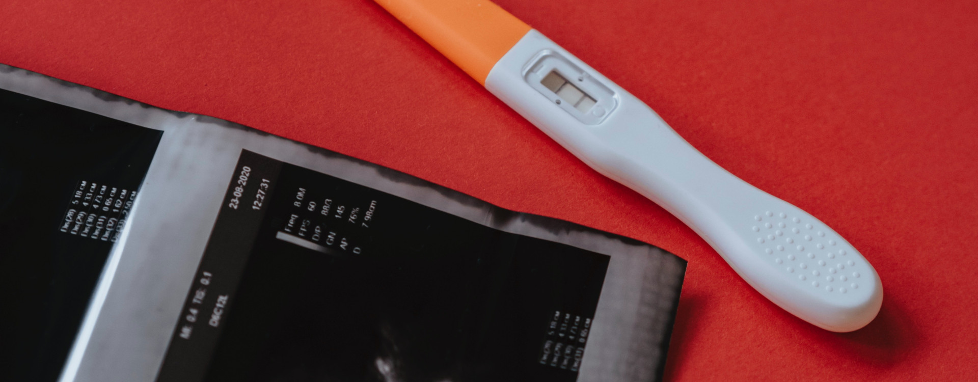 Symbolbild: Positiver Schwangerschaftstest und Ultraschallbild auf einem Tisch